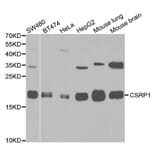 Western blot - CSRP1 Antibody from Signalway Antibody (32145) - Antibodies.com