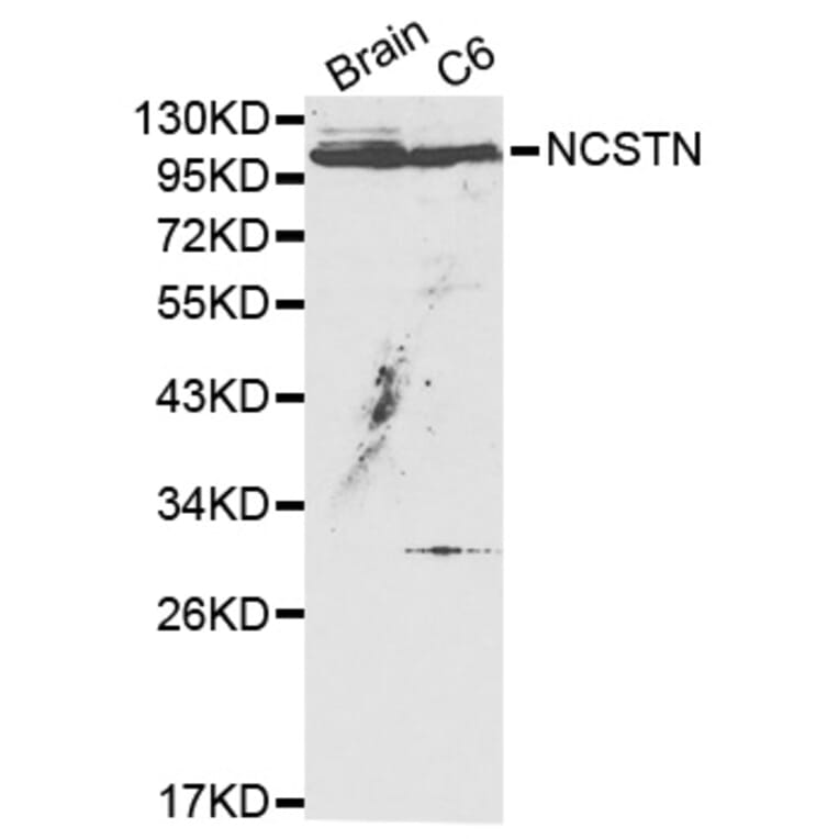 Western blot - NCSTN Antibody from Signalway Antibody (32159) - Antibodies.com