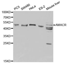 Western blot - AMACR Antibody from Signalway Antibody (32171) - Antibodies.com
