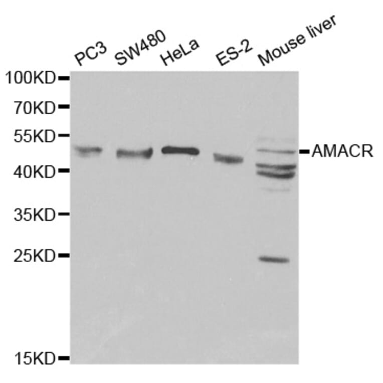 Western blot - AMACR Antibody from Signalway Antibody (32171) - Antibodies.com