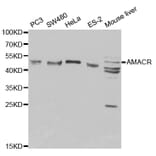 Western blot - AMACR Antibody from Signalway Antibody (32171) - Antibodies.com