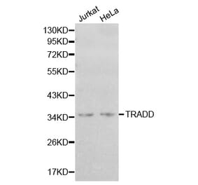 Western blot - TRADD Antibody from Signalway Antibody (32181) - Antibodies.com