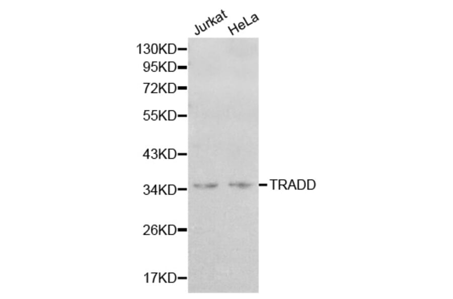 Western blot - TRADD Antibody from Signalway Antibody (32181) - Antibodies.com