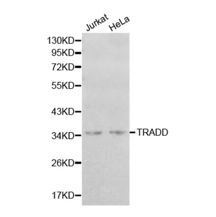 Western blot - TRADD Antibody from Signalway Antibody (32181) - Antibodies.com