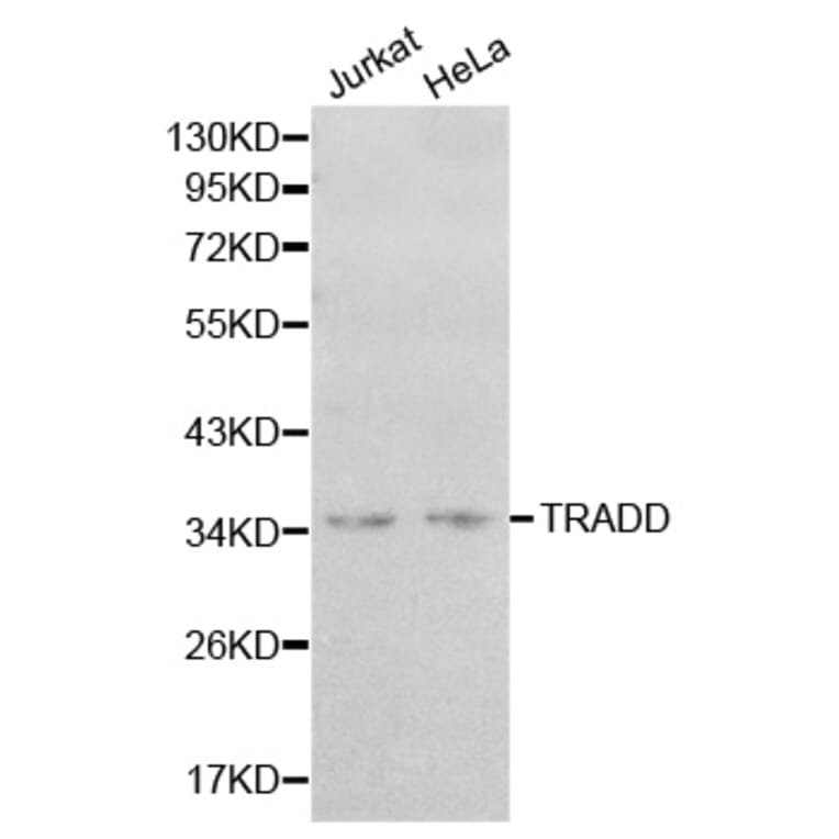 Western blot - TRADD Antibody from Signalway Antibody (32181) - Antibodies.com