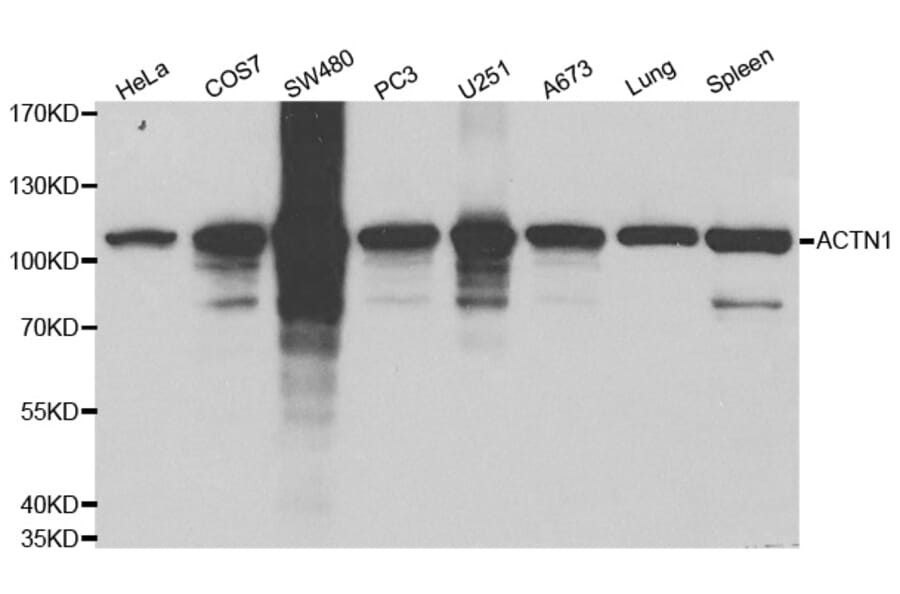 Western blot - ACTN1 Antibody from Signalway Antibody (32192) - Antibodies.com