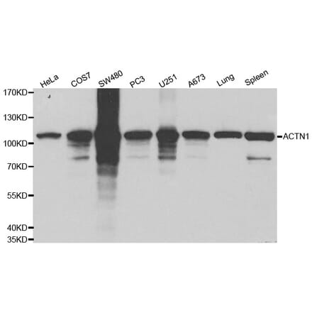 Western blot - ACTN1 Antibody from Signalway Antibody (32192) - Antibodies.com