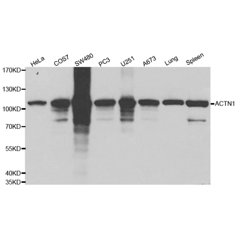 Western blot - ACTN1 Antibody from Signalway Antibody (32192) - Antibodies.com