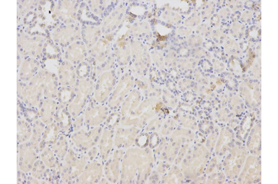 Immunohistochemistry - ACTN1 Antibody from Signalway Antibody (32192) - Antibodies.com