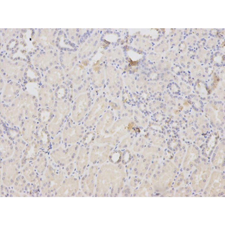 Immunohistochemistry - ACTN1 Antibody from Signalway Antibody (32192) - Antibodies.com