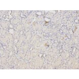 Immunohistochemistry - ACTN1 Antibody from Signalway Antibody (32192) - Antibodies.com