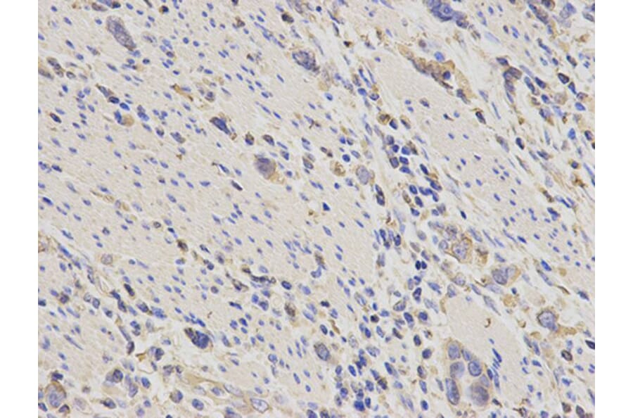 Immunohistochemistry - ACTN1 Antibody from Signalway Antibody (32192) - Antibodies.com