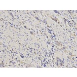 Immunohistochemistry - ACTN1 Antibody from Signalway Antibody (32192) - Antibodies.com