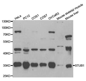 Western blot - STUB1 Antibody from Signalway Antibody (32199) - Antibodies.com