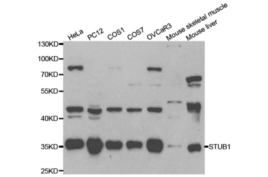 Western blot - STUB1 Antibody from Signalway Antibody (32199) - Antibodies.com