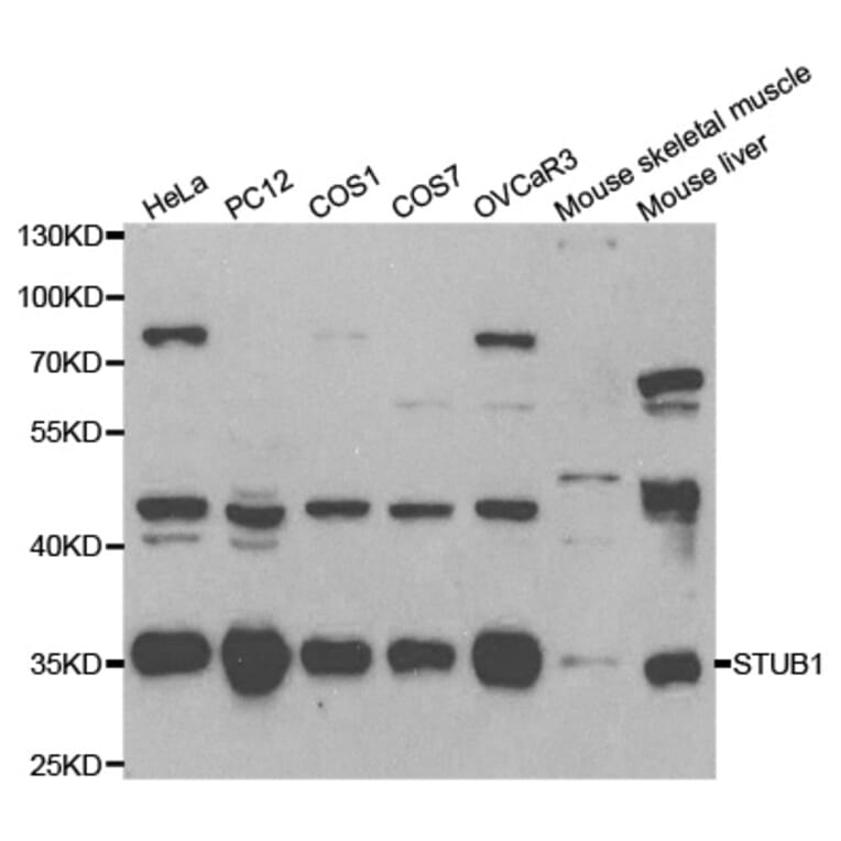 Western blot - STUB1 Antibody from Signalway Antibody (32199) - Antibodies.com