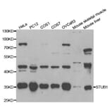 Western blot - STUB1 Antibody from Signalway Antibody (32199) - Antibodies.com