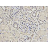 Immunohistochemistry - CAPN1 Antibody from Signalway Antibody (32201) - Antibodies.com