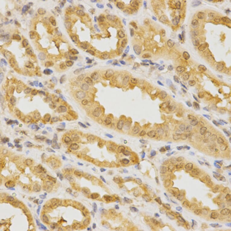 Immunohistochemistry - CDC42 Antibody from Signalway Antibody (32214) - Antibodies.com