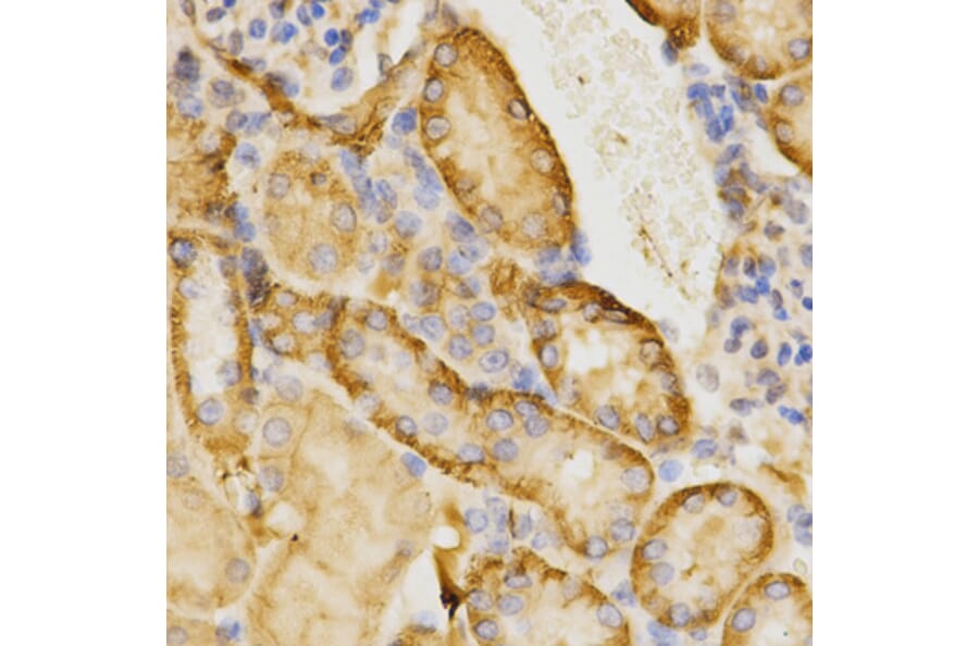 Immunohistochemistry - CDC42 Antibody from Signalway Antibody (32214) - Antibodies.com