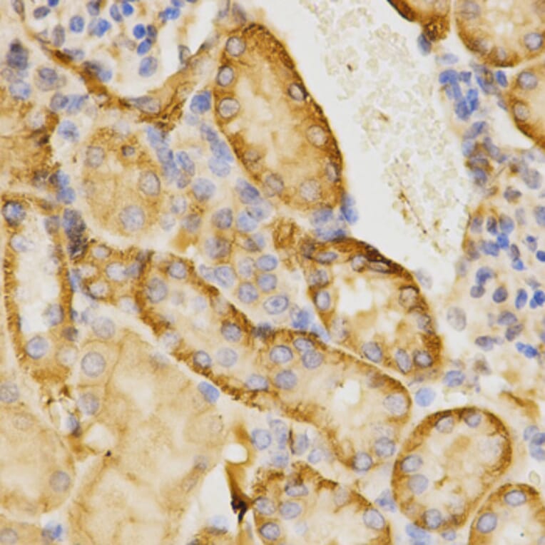 Immunohistochemistry - CDC42 Antibody from Signalway Antibody (32214) - Antibodies.com