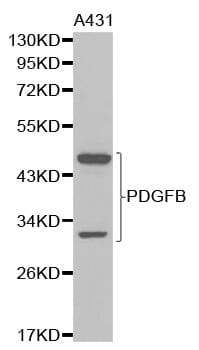 Western blot analysis of extracts of A431 cell lines using PDGFB antibody.