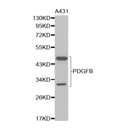 Western blot - PDGFB Antibody from Signalway Antibody (32219) - Antibodies.com