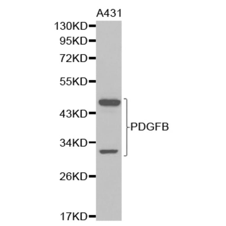 Western blot - PDGFB Antibody from Signalway Antibody (32219) - Antibodies.com