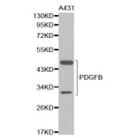 Western blot - PDGFB Antibody from Signalway Antibody (32219) - Antibodies.com