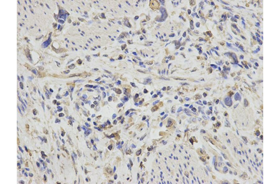 Immunohistochemistry - PDGFB Antibody from Signalway Antibody (32219) - Antibodies.com