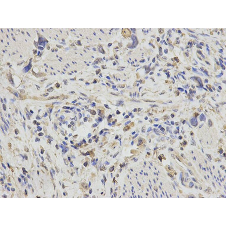 Immunohistochemistry - PDGFB Antibody from Signalway Antibody (32219) - Antibodies.com