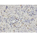Immunohistochemistry - PDGFB Antibody from Signalway Antibody (32219) - Antibodies.com