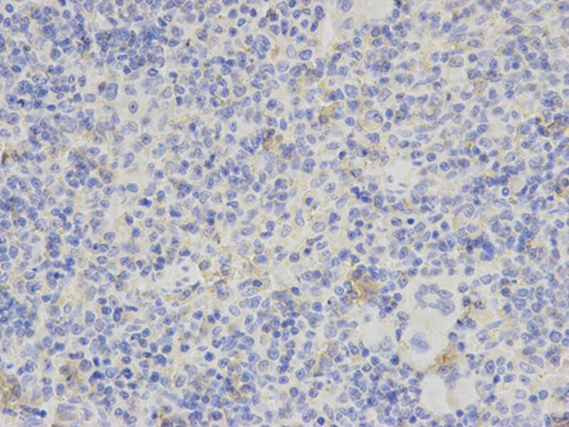 Immunohistochemical analysis of paraffin-embedded rat spleen using PDGFB antibody at dilution of 1: 200 (400x lens).