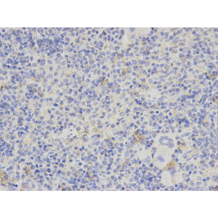 Immunohistochemistry - PDGFB Antibody from Signalway Antibody (32219) - Antibodies.com