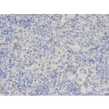 Immunohistochemistry - PDGFB Antibody from Signalway Antibody (32219) - Antibodies.com