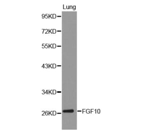 Western blot - FGF10 Antibody from Signalway Antibody (32224) - Antibodies.com