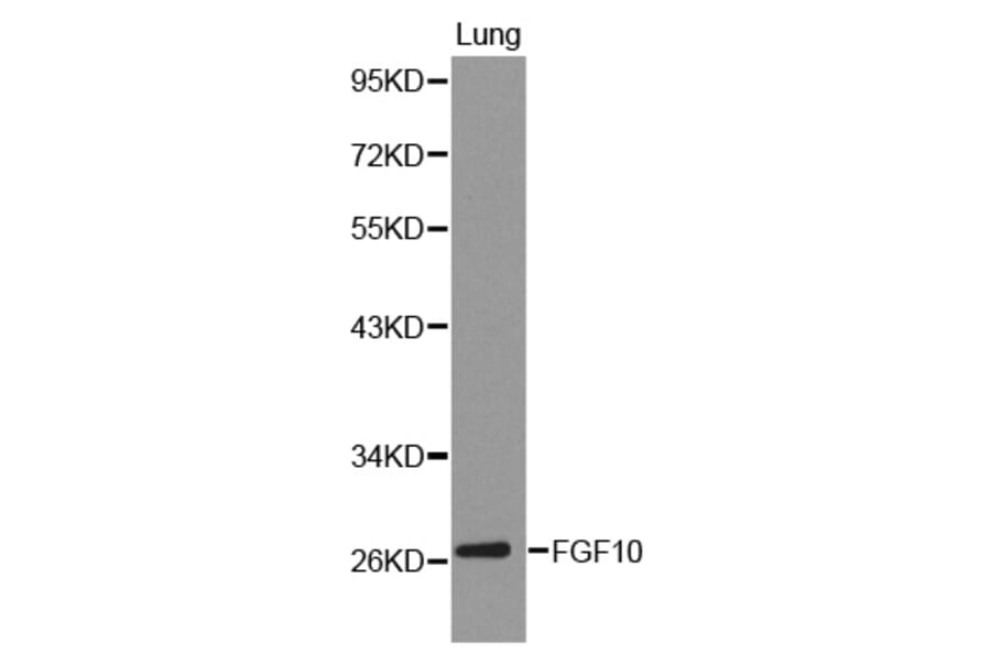 Western blot - FGF10 Antibody from Signalway Antibody (32224) - Antibodies.com