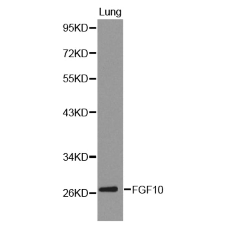 Western blot - FGF10 Antibody from Signalway Antibody (32224) - Antibodies.com
