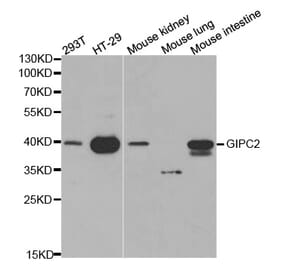 Western blot - GIPC2 Antibody from Signalway Antibody (32240) - Antibodies.com