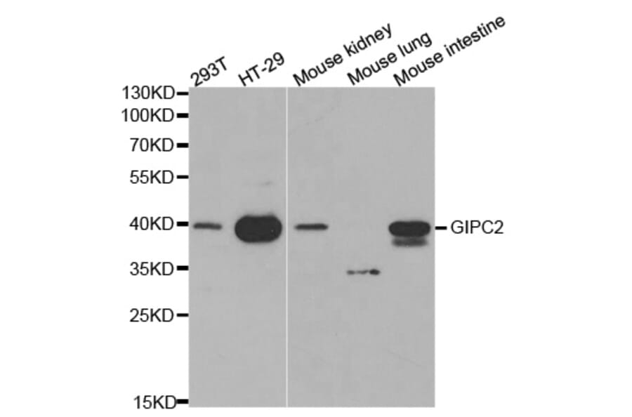 Western blot - GIPC2 Antibody from Signalway Antibody (32240) - Antibodies.com