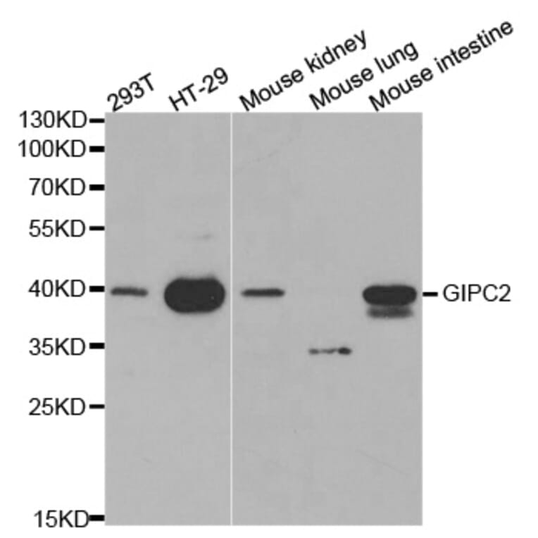 Western blot - GIPC2 Antibody from Signalway Antibody (32240) - Antibodies.com