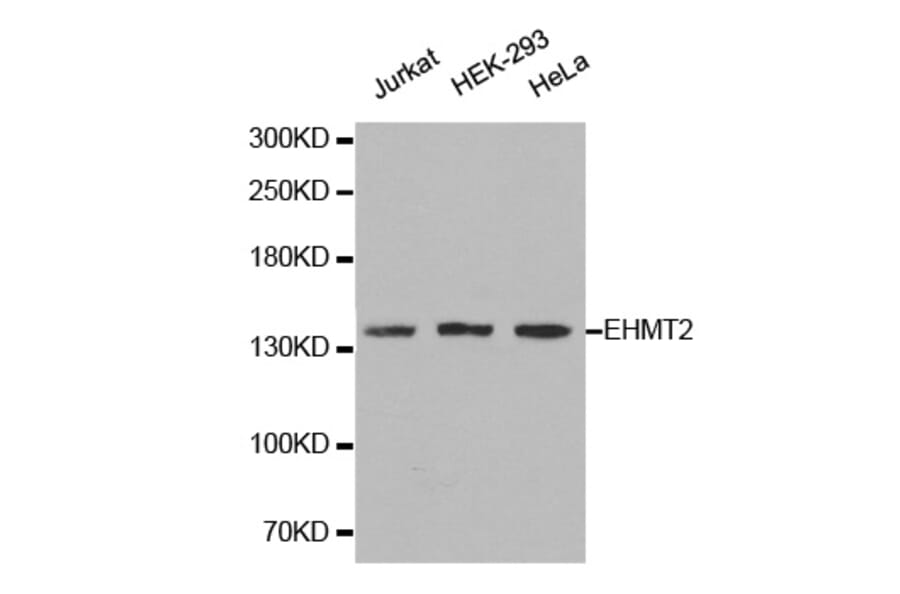 Western blot - EHMT2 Antibody from Signalway Antibody (32257) - Antibodies.com
