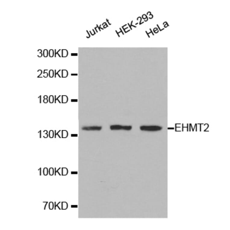 Western blot - EHMT2 Antibody from Signalway Antibody (32257) - Antibodies.com