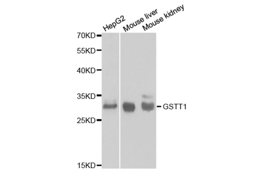 Western blot - GSTT1 Antibody from Signalway Antibody (32261) - Antibodies.com
