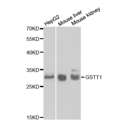 Western blot - GSTT1 Antibody from Signalway Antibody (32261) - Antibodies.com