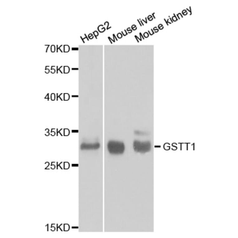 Western blot - GSTT1 Antibody from Signalway Antibody (32261) - Antibodies.com
