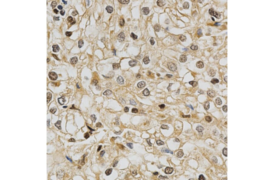 Immunohistochemistry - GSTT1 Antibody from Signalway Antibody (32261) - Antibodies.com