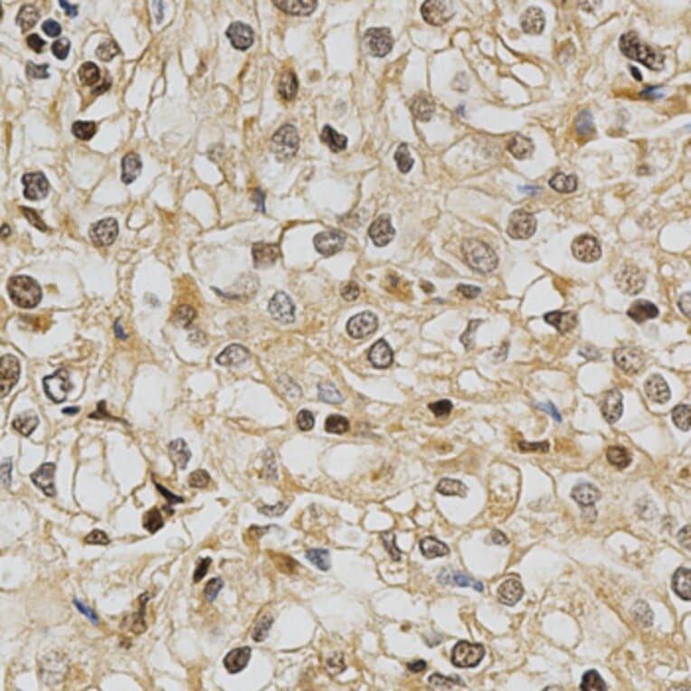 Immunohistochemistry - GSTT1 Antibody from Signalway Antibody (32261) - Antibodies.com