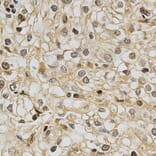 Immunohistochemistry - GSTT1 Antibody from Signalway Antibody (32261) - Antibodies.com