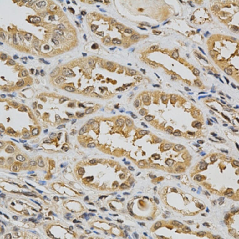 Immunohistochemistry - GSTT1 Antibody from Signalway Antibody (32261) - Antibodies.com